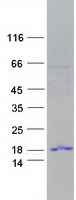 TP53TG3 Protein - Purified recombinant protein TP53TG3 was analyzed by SDS-PAGE gel and Coomassie Blue Staining