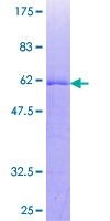 TP53TG5 Protein - 12.5% SDS-PAGE of human C20orf10 stained with Coomassie Blue