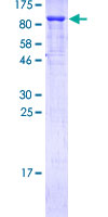 TP73 / p73 Protein - 12.5% SDS-PAGE of human TP73 stained with Coomassie Blue