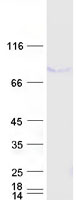 TP73 / p73 Protein - Purified recombinant protein TP73 was analyzed by SDS-PAGE gel and Coomassie Blue Staining