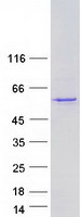 TP73 / p73 Protein - Purified recombinant protein TP73 was analyzed by SDS-PAGE gel and Coomassie Blue Staining