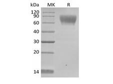 TPBG / 5T4 Protein - Recombinant Human TPBG/5T4 (C-Avi-6His) Biotinylated