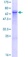 TPBG / 5T4 Protein - 12.5% SDS-PAGE of human TPBG stained with Coomassie Blue