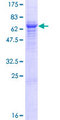 TPBG / 5T4 Protein - 12.5% SDS-PAGE of human TPBG stained with Coomassie Blue