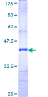 TPBG / 5T4 Protein - 12.5% SDS-PAGE Stained with Coomassie Blue.