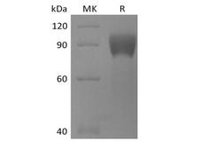 TPBG / 5T4 Protein - Recombinant Human TPBG/5T4 (C-mFc)