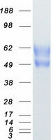 TPBG / 5T4 Protein - Purified recombinant protein TPBG was analyzed by SDS-PAGE gel and Coomassie Blue Staining