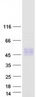 TPBGL Protein - Purified recombinant protein TPBGL was analyzed by SDS-PAGE gel and Coomassie Blue Staining