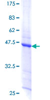TPD52L1 Protein - 12.5% SDS-PAGE of human TPD52L1 stained with Coomassie Blue