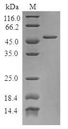 TPD52L1 Protein - (Tris-Glycine gel) Discontinuous SDS-PAGE (reduced) with 5% enrichment gel and 15% separation gel.