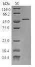 TPD52L1 Protein - (Tris-Glycine gel) Discontinuous SDS-PAGE (reduced) with 5% enrichment gel and 15% separation gel.