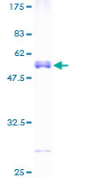 TPD52L2 / HD54 Protein - 12.5% SDS-PAGE of human TPD52L2 stained with Coomassie Blue