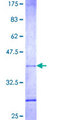 TPD52L2 / HD54 Protein - 12.5% SDS-PAGE Stained with Coomassie Blue.