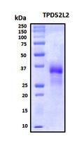 TPD52L2 / HD54 Protein