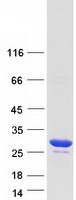 TPD52L2 / HD54 Protein - Purified recombinant protein TPD52L2 was analyzed by SDS-PAGE gel and Coomassie Blue Staining