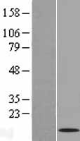 TPD52L3 Protein - Western validation with an anti-DDK antibody * L: Control HEK293 lysate R: Over-expression lysate