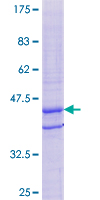 TPD52L3 Protein - 12.5% SDS-PAGE of human TPD52L3 stained with Coomassie Blue