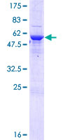 TPGS2 / C18orf10 Protein - 12.5% SDS-PAGE of human C18orf10 stained with Coomassie Blue