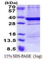 TPGS2 / C18orf10 Protein