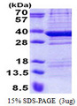 TPGS2 / C18orf10 Protein