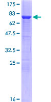 TPH1 / Tryptophan Hydroxylase Protein - 12.5% SDS-PAGE of human TPH1 stained with Coomassie Blue