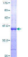TPH1 / Tryptophan Hydroxylase Protein - 12.5% SDS-PAGE Stained with Coomassie Blue.