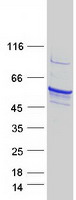 TPH1 / Tryptophan Hydroxylase Protein - Purified recombinant protein TPH1 was analyzed by SDS-PAGE gel and Coomassie Blue Staining