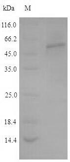 TPH2 Protein - (Tris-Glycine gel) Discontinuous SDS-PAGE (reduced) with 5% enrichment gel and 15% separation gel.