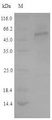 TPH2 Protein - (Tris-Glycine gel) Discontinuous SDS-PAGE (reduced) with 5% enrichment gel and 15% separation gel.