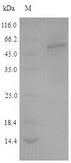TPH2 Protein - (Tris-Glycine gel) Discontinuous SDS-PAGE (reduced) with 5% enrichment gel and 15% separation gel.