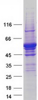 TPH2 Protein - Purified recombinant protein TPH2 was analyzed by SDS-PAGE gel and Coomassie Blue Staining