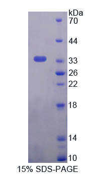 TPI1 / TPI Protein - Recombinant  Triosephosphate Isomerase 1 By SDS-PAGE