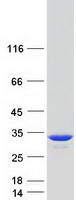TPI1 / TPI Protein - Purified recombinant protein TPI1 was analyzed by SDS-PAGE gel and Coomassie Blue Staining