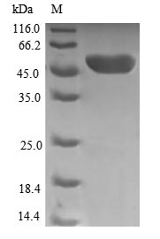 TPK1 Protein - (Tris-Glycine gel) Discontinuous SDS-PAGE (reduced) with 5% enrichment gel and 15% separation gel.
