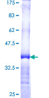 TPK1 Protein - 12.5% SDS-PAGE Stained with Coomassie Blue.