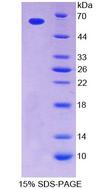 TPK1 Protein - Recombinant  Tau-Protein Kinase 1 By SDS-PAGE