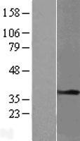TPM1 / Tropomyosin Protein - Western validation with an anti-DDK antibody * L: Control HEK293 lysate R: Over-expression lysate