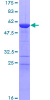 TPM1 / Tropomyosin Protein - 12.5% SDS-PAGE of human TPM1 stained with Coomassie Blue