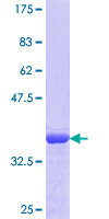 TPM1 / Tropomyosin Protein - 12.5% SDS-PAGE Stained with Coomassie Blue.