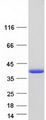 TPM1 / Tropomyosin Protein - Purified recombinant protein TPM1 was analyzed by SDS-PAGE gel and Coomassie Blue Staining