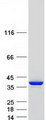 TPM1 / Tropomyosin Protein - Purified recombinant protein TPM1 was analyzed by SDS-PAGE gel and Coomassie Blue Staining