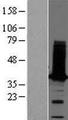 TPM2 Protein - Western validation with an anti-DDK antibody * L: Control HEK293 lysate R: Over-expression lysate