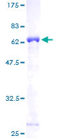 TPM2 Protein - 12.5% SDS-PAGE of human TPM2 stained with Coomassie Blue