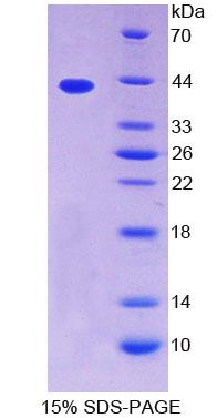 TPM2 Protein - Recombinant  Tropomyosin 2 Beta By SDS-PAGE
