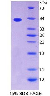 TPM2 Protein - Recombinant  Tropomyosin 2 Beta By SDS-PAGE