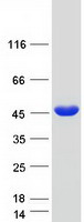 TPM2 Protein - Purified recombinant protein TPM2 was analyzed by SDS-PAGE gel and Coomassie Blue Staining