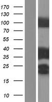 TPM3 Protein - Western validation with an anti-DDK antibody * L: Control HEK293 lysate R: Over-expression lysate