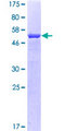 TPM3 Protein - 12.5% SDS-PAGE of human TPM3 stained with Coomassie Blue