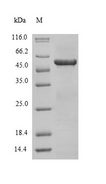 TPM3 Protein - (Tris-Glycine gel) Discontinuous SDS-PAGE (reduced) with 5% enrichment gel and 15% separation gel.