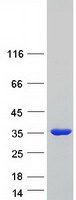 TPM3 Protein - Purified recombinant protein TPM3 was analyzed by SDS-PAGE gel and Coomassie Blue Staining